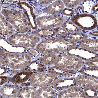 ARF6 Recombinant Rabbit mAb (S-4283-62)