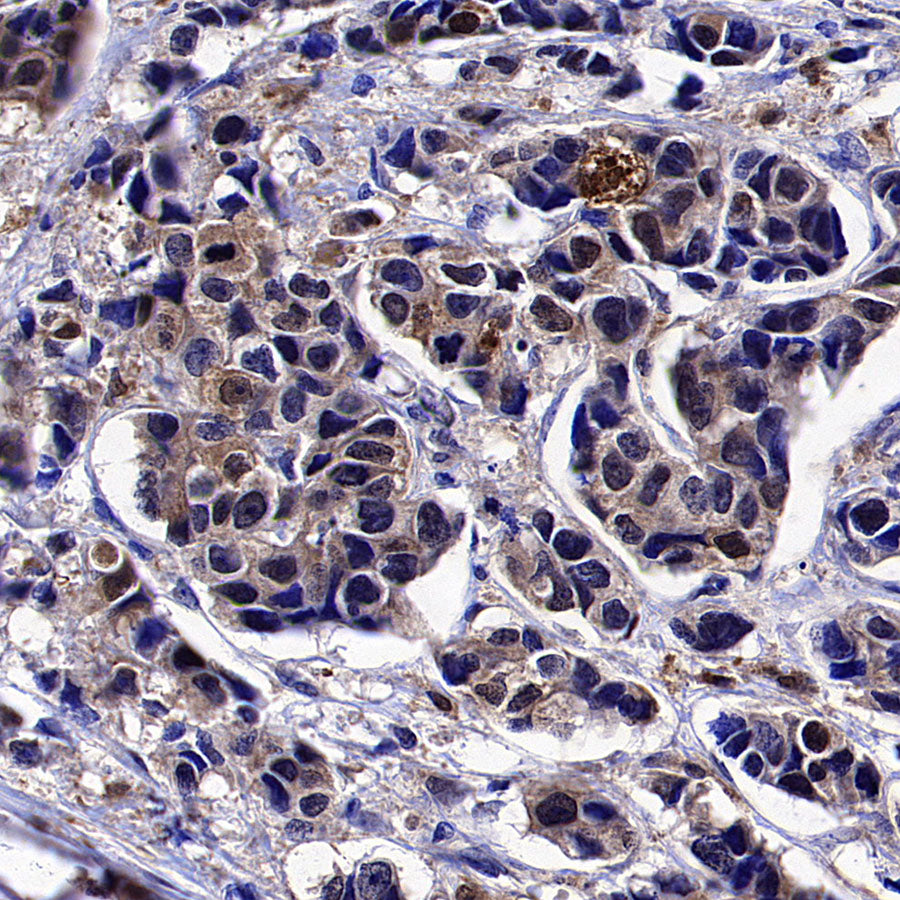 ISG15 Recombinant Rabbit mAb (S-5475)