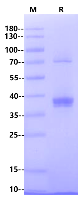 Biotinylated CD20 Flag&Avi Tag Full Length Protein, Human (Detergent)