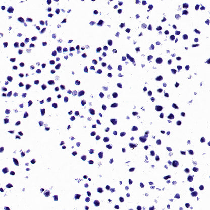 PTK7 Recombinant Rabbit mAb ,PBS Only(SDT-2432-156)