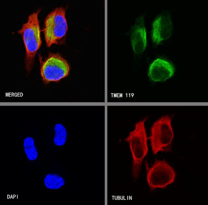 TMEM119 Recombinant Rabbit mAb (S-1040-14)