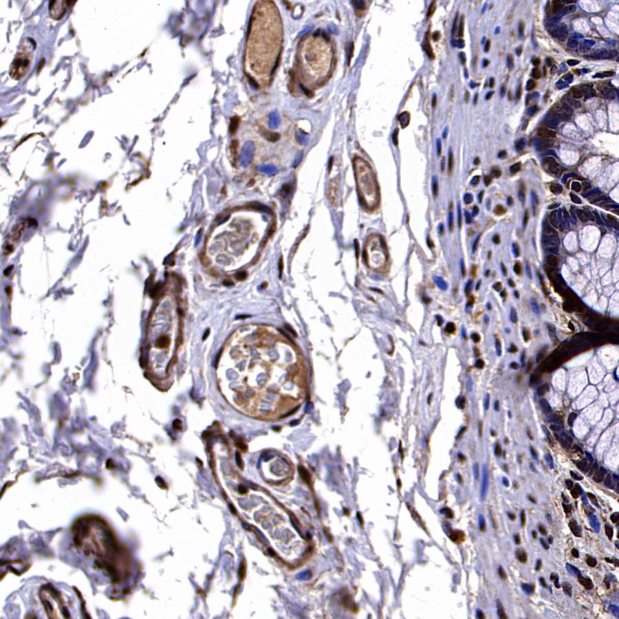 VEGFA Recombinant Rabbit mAb (S-5301)