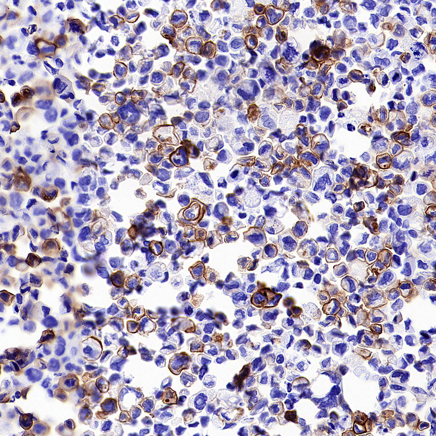 CDH17 Recombinant Rabbit mAb (SDT-3276-11)