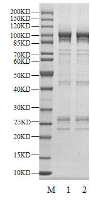 PRKCH(PKCη) GST Tag Protein, Human