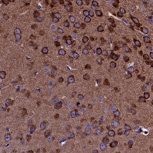 FAK Recombinant Rabbit mAb (S-1180-10)