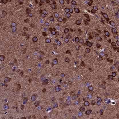 FAK Recombinant Rabbit mAb (S-1180-10)