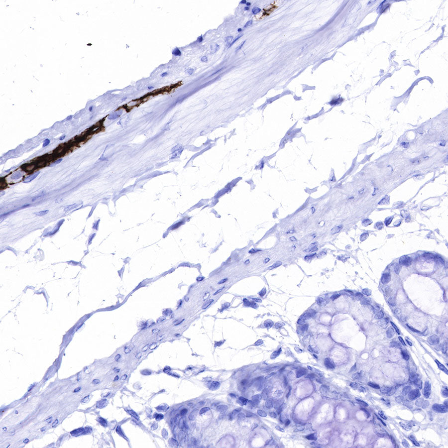 GFAP Recombinant Rabbit mAb (SDT-306-10)