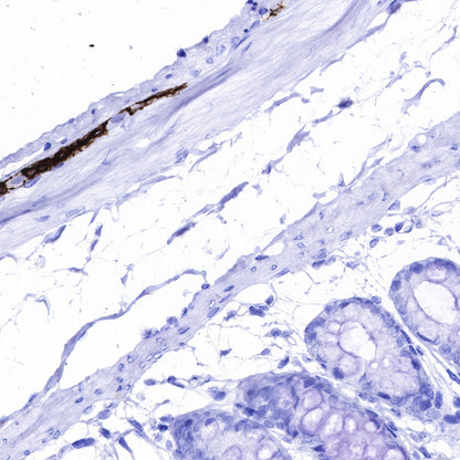 GFAP Recombinant Rabbit mAb (SDT-306-10)