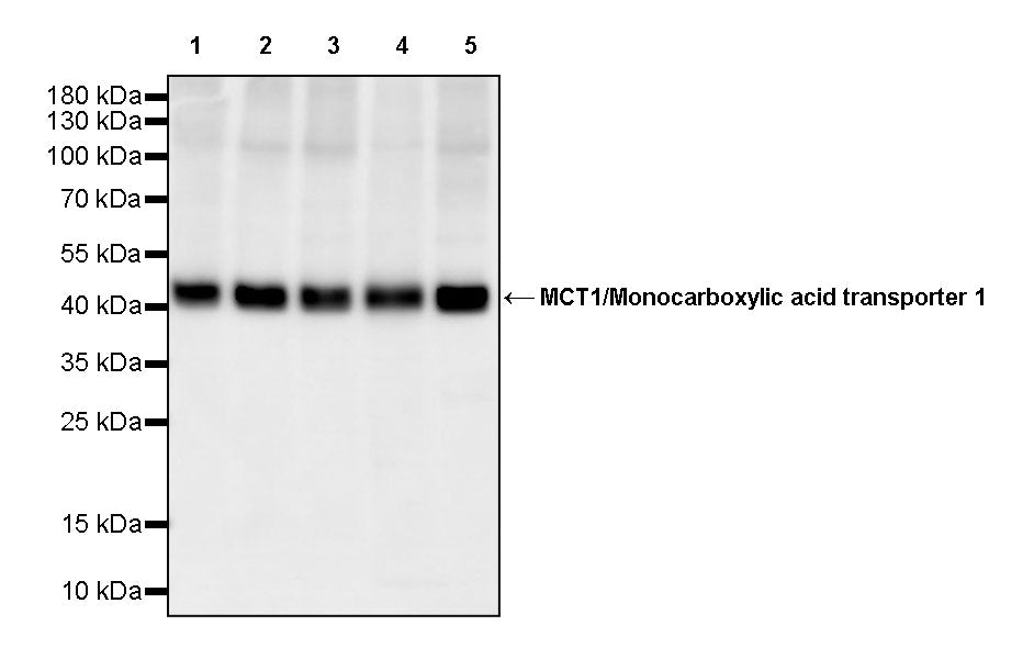 MCT1/Monocarboxylic acid transporter 1 Recombinant Rabbit mAb (S-5144)