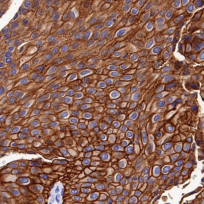 Integrin beta 6 Recombinant Rabbit mAb (SDT-1445-78)