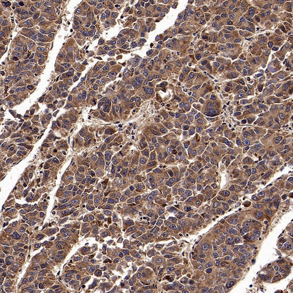 CAD/BM1 Recombinant Rabbit mAb (S-1650-72)