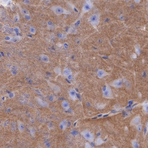 PSD-95 Recombinant Rabbit mAb (S-R311)