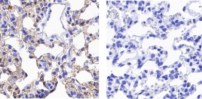 Phosphotyrosine Rabbit mAb (S-R207)