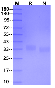 BTN1A1/Butyrophilin His Tag Protein, Human