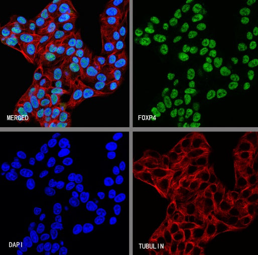 FOXP4 Recombinant Rabbit mAb (S-6198)