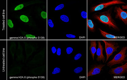 Phospho-gamma H2A.X (Ser139) Recombinant Rabbit mAb (S-981-56)
