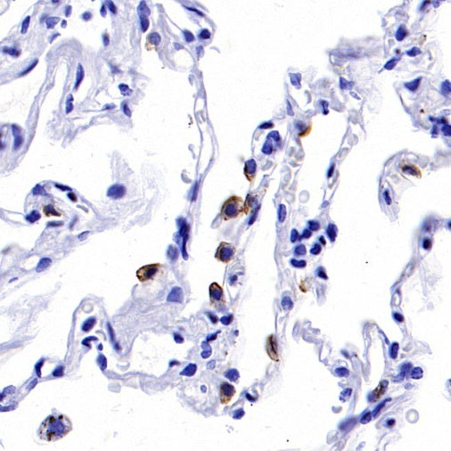 NaPi2b/SLC34A2 Recombinant Rabbit mAb (SDT-R229)
