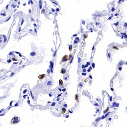 NaPi2b/SLC34A2 Recombinant Rabbit mAb (SDT-R229)