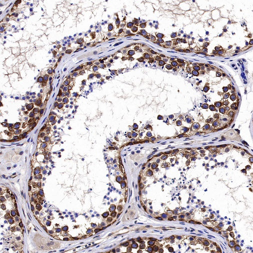 YTHDF2 Recombinant Rabbit mAb (S-1569-42)