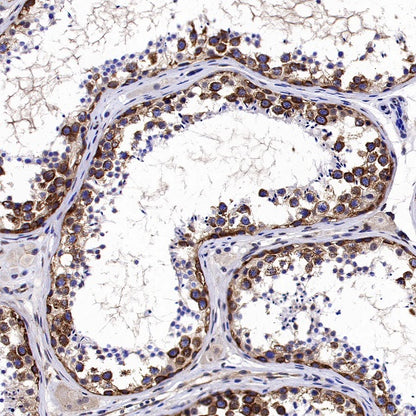 YTHDF2 Recombinant Rabbit mAb (S-1569-42)