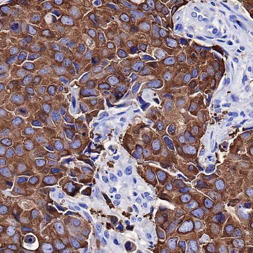 FASN Recombinant Rabbit mAb (S-682-32)