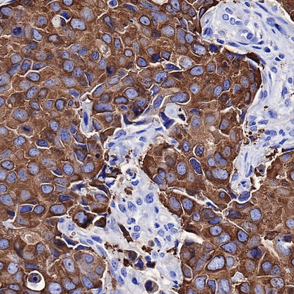 FASN Recombinant Rabbit mAb (S-682-32)