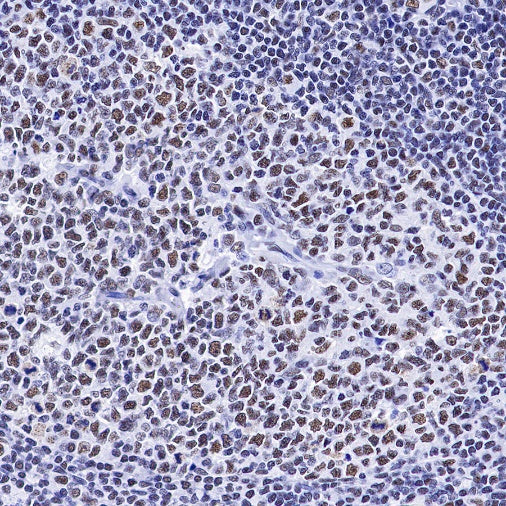 U2AF2 Recombinant Rabbit mAb (S-1324-66)