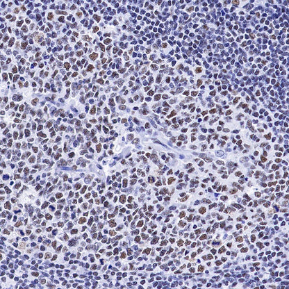 U2AF2 Recombinant Rabbit mAb (S-1324-66)