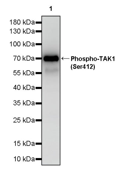 Phospho-TAK1 (Ser412) Recombinant Rabbit mAb (S-3334-138)