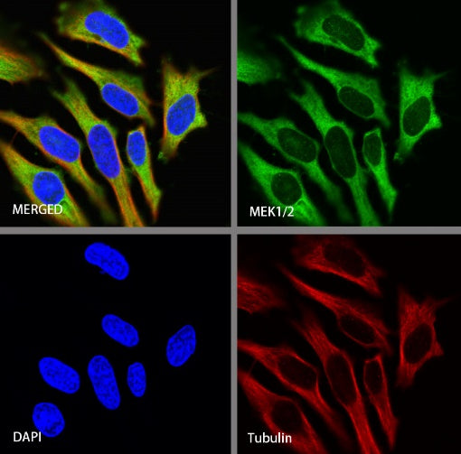 MEK1/2 Recombinant Rabbit mAb (S-834-101)