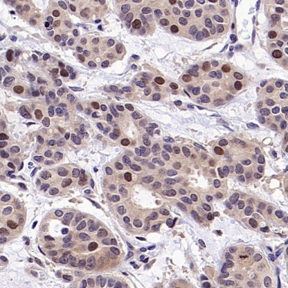 BRCA1 Recombinant Mouse mAb (S-4707)