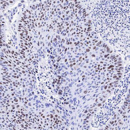CHAF1b Recombinant Rabbit mAb (S-R316)