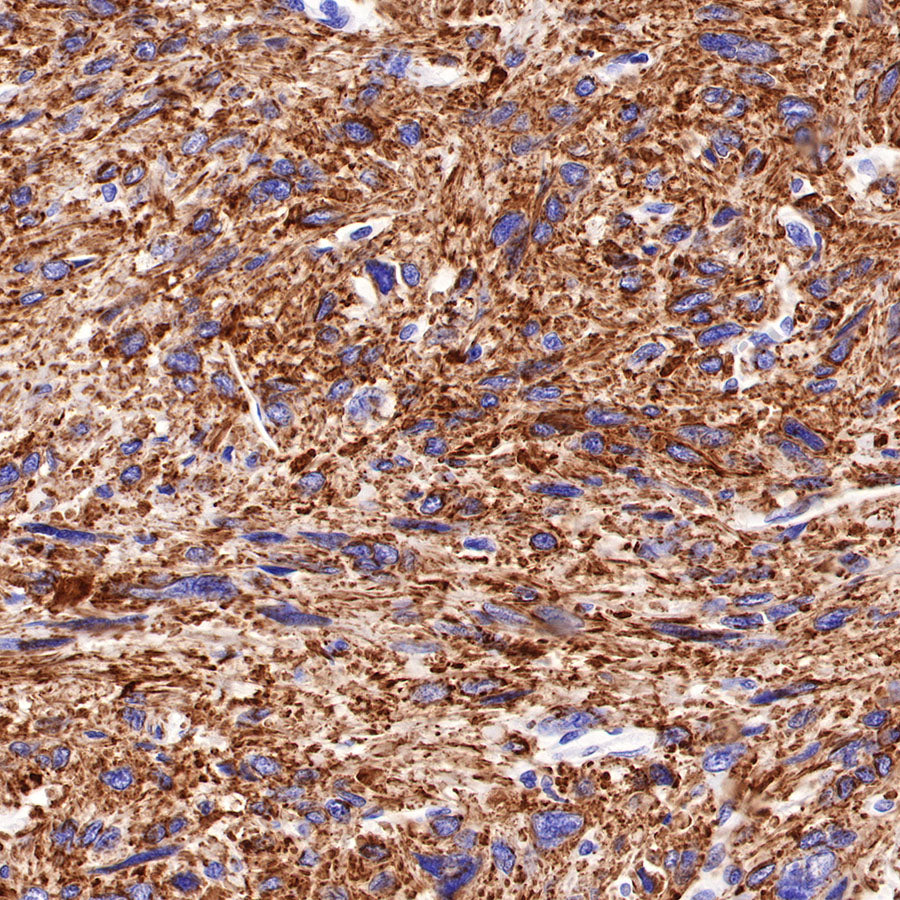 Myosin-11/SMMHC Recombinant Rabbit mAb,PBS Only (SDT-188-112)