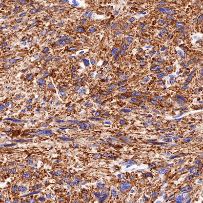 Myosin-11/SMMHC Recombinant Rabbit mAb,PBS Only (SDT-188-112)
