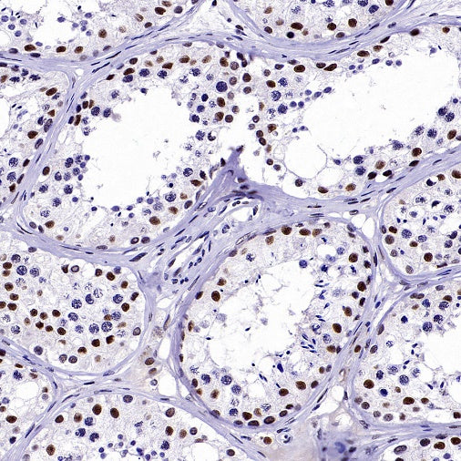 CDK9 Recombinant Rabbit mAb (S-2661-10)