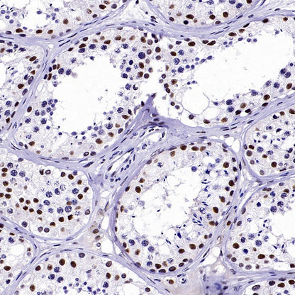 CDK9 Recombinant Rabbit mAb (S-2661-10)