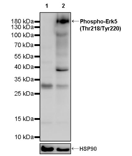 Phospho-Erk5 (Thr218/Tyr220) Recombinant Rabbit mAb (S-3538-42)