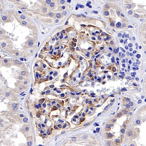 VEGF Receptor 2/FLK-1 Recombinant Rabbit mAb (S-R400)
