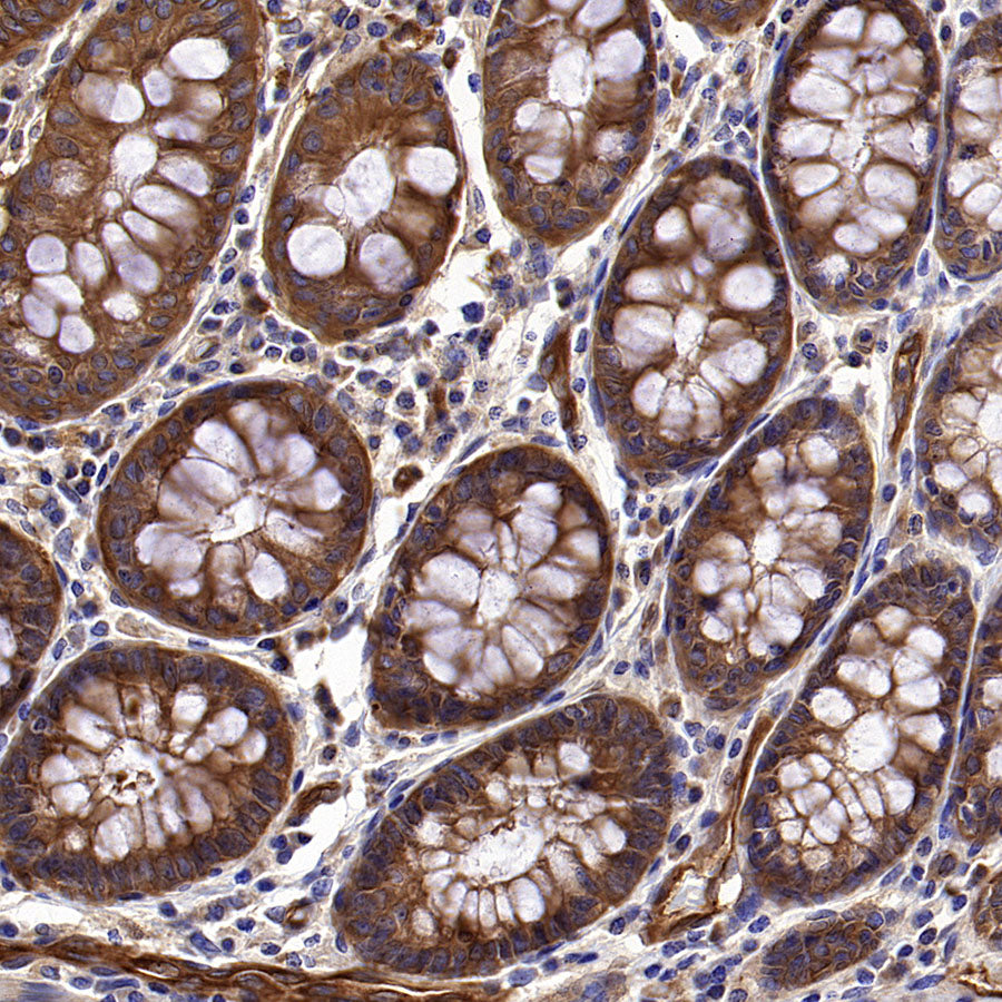 BCAR1 Recombinant Rabbit mAb (S-3542-49)