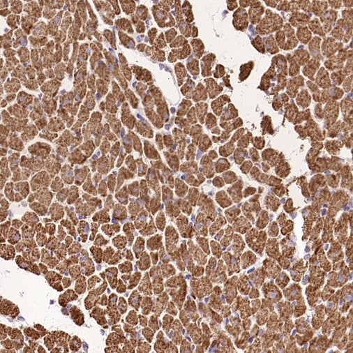 UQCRC2 Recombinant Rabbit mAb (S-2374-127)