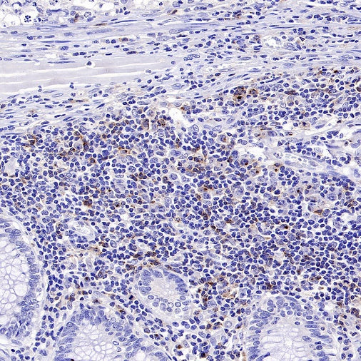 CD70 Recombinant Rabbit mAb (S-1725-277)