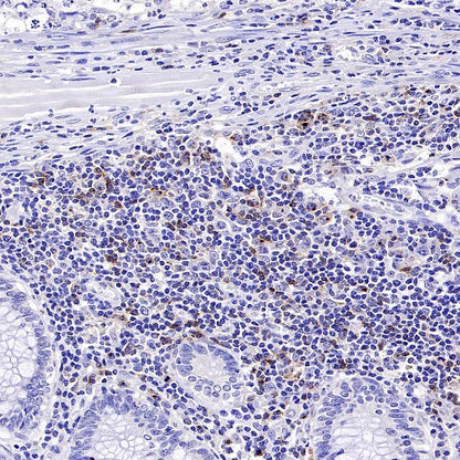 CD70 Recombinant Rabbit mAb (S-1725-277)