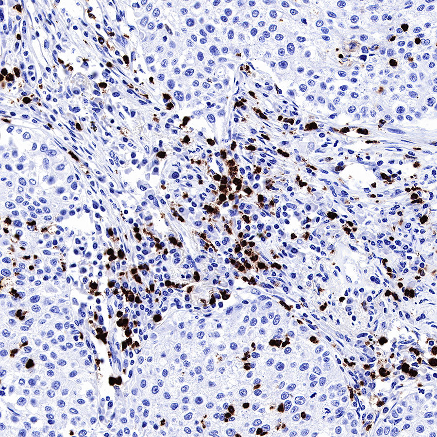 MPO Recombinant Rabbit mAb (SDT-224-19)
