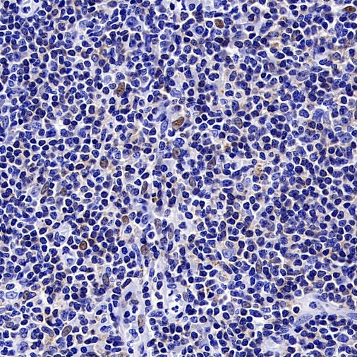 FOXC1 Recombinant Rabbit mAb (S-1607-142)