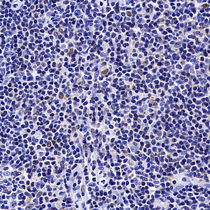FOXC1 Recombinant Rabbit mAb (S-1607-142)