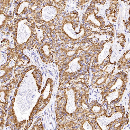 SHMT2/SHMT Recombinant Rabbit mAb (S-1581-5)