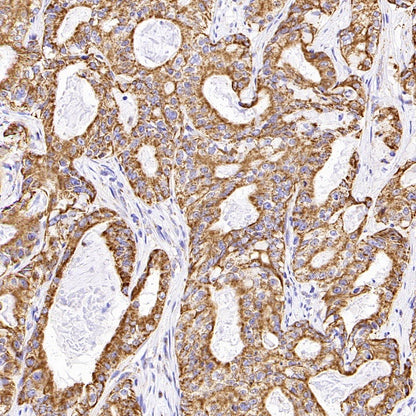 SHMT2/SHMT Recombinant Rabbit mAb (S-1581-5)
