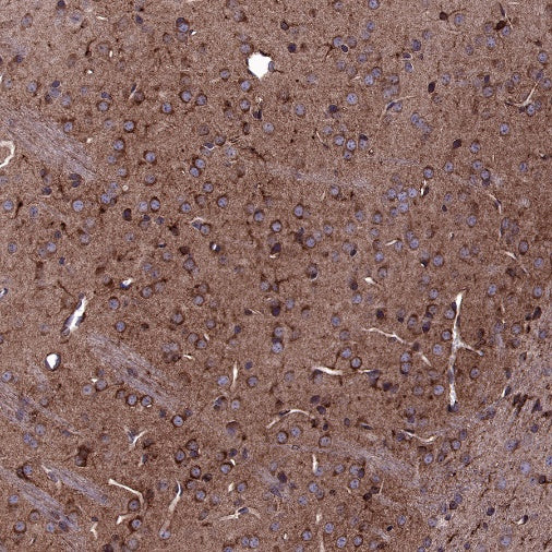 5HT1A Receptor Rabbit Polyclonal Antibody