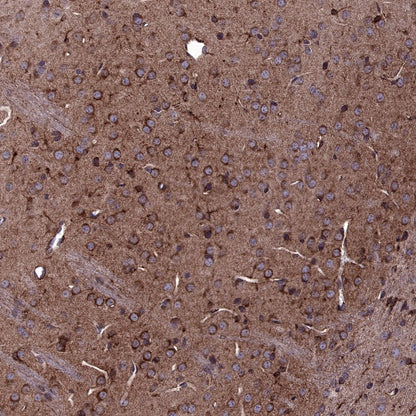 5HT1A Receptor Rabbit Polyclonal Antibody