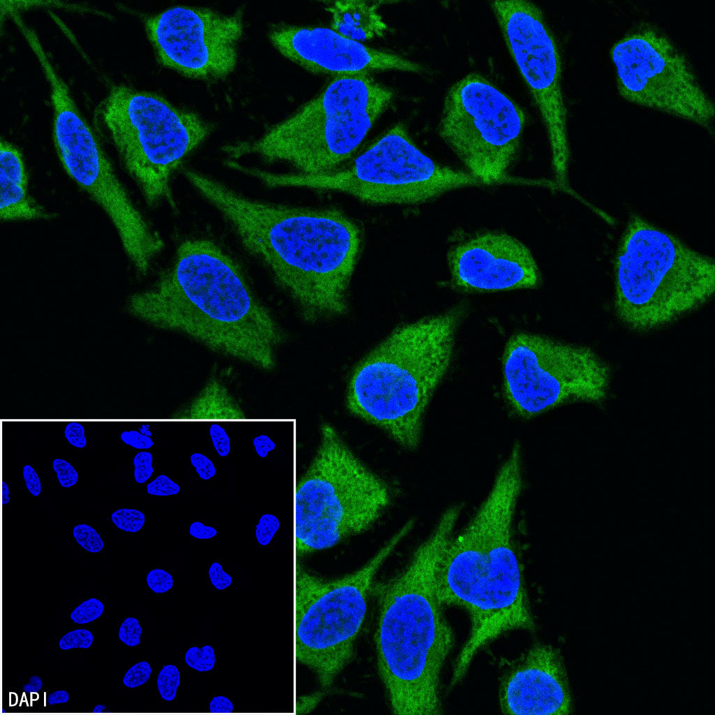 GAPDH Recombinant Rabbit mAb (FITC Conjugate) (S-240-147)